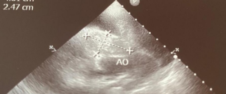 PRZYPADEK NIECZĘSTO SPOTYKANY